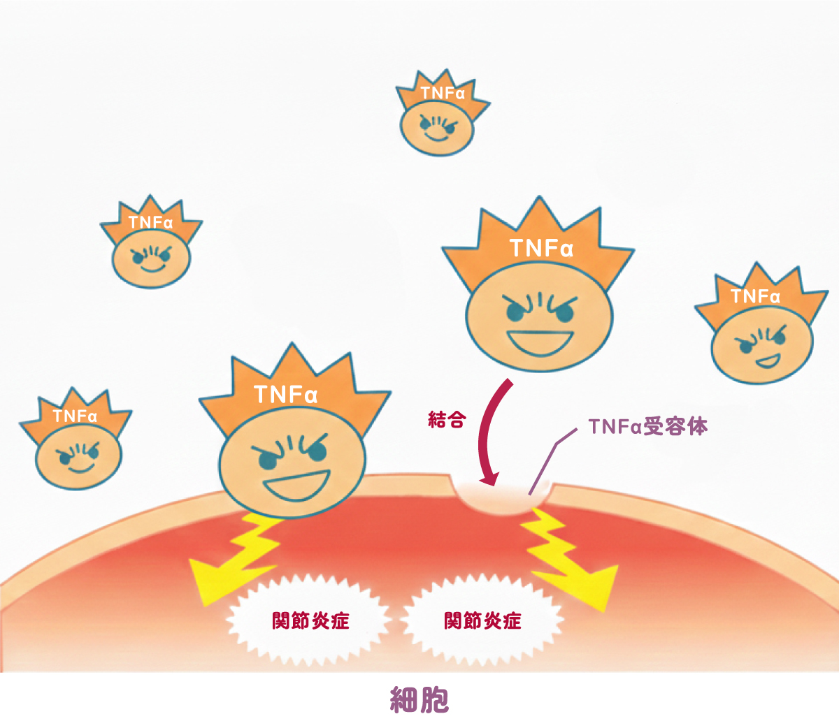 炎症を悪化させるTNFαのはたらきを抑える、エンブレル