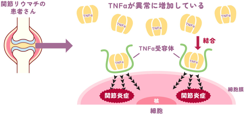 シンポニー®は炎症を悪化させるＴＮＦαのはたらきを抑えます
