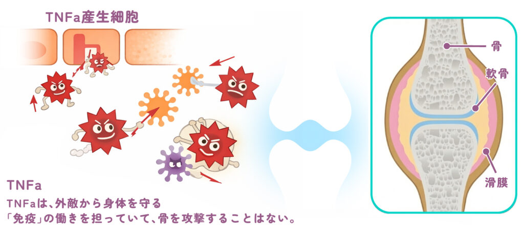 正常な関節では、異物を攻撃